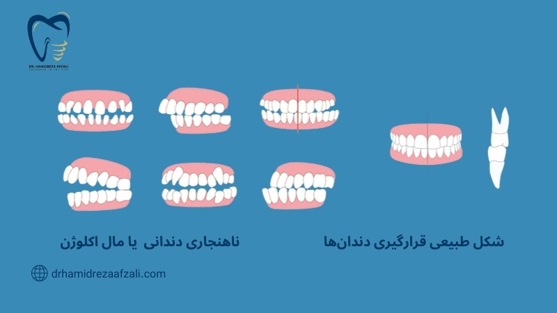 ناهنجاری دندانی در زوایای مختلف نشان داد شده است