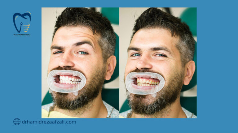 عکس از شخصی در دندانپزشکی
