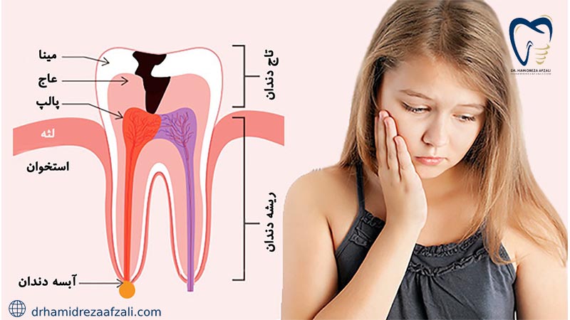 کودکی در کنار اجزای مختلف دندان