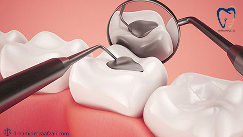 ترمیم دندان یکی از روش های درمان دهان و دندان