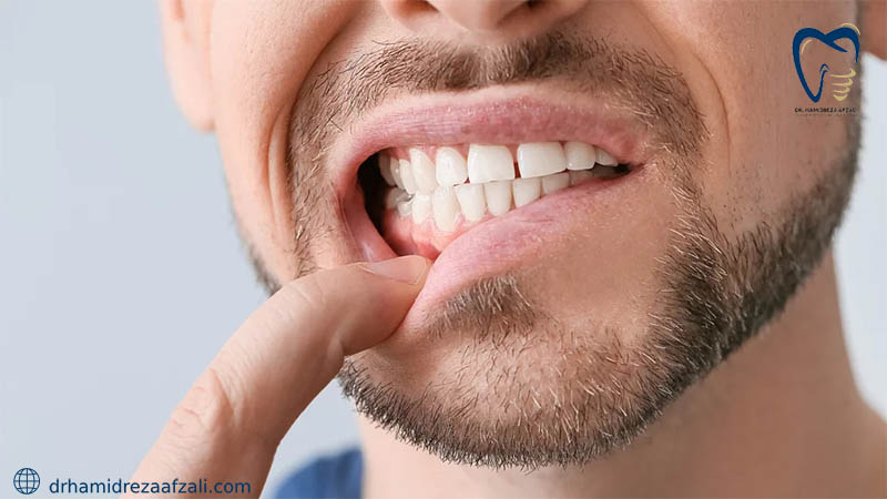 نشان دادن دندان پوسیده در دهان توسط شخصی