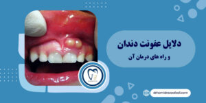 دلایل عفونت دندان و راه های درمان آن