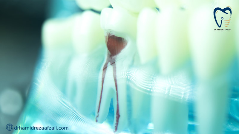 نمایی از ریشه دندان از داخل دندان