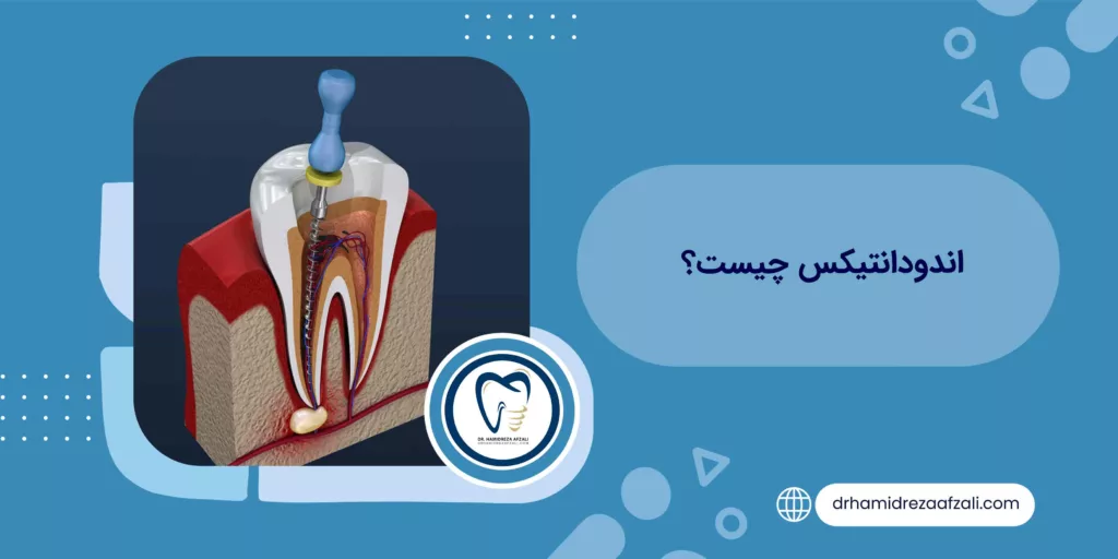 اندودانتیکس چیست؟