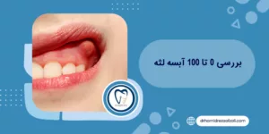 بررسی 0 تا 100 آبسه لثه