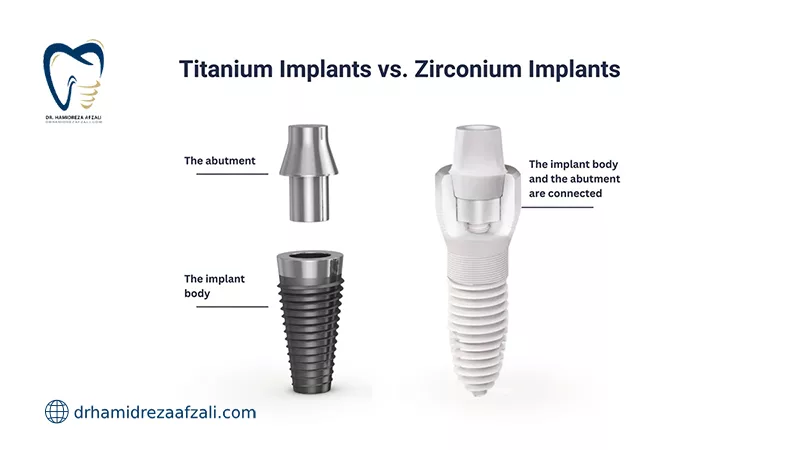 مقایسه ایمپلنت تیتانیوم با ایمپلنت زیرکونیا