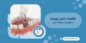 اباتمنت دندان چیست و نقش آن در ایمپلنت دندان