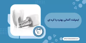 ایمپلنت آلمانی بهتره یا کره ای